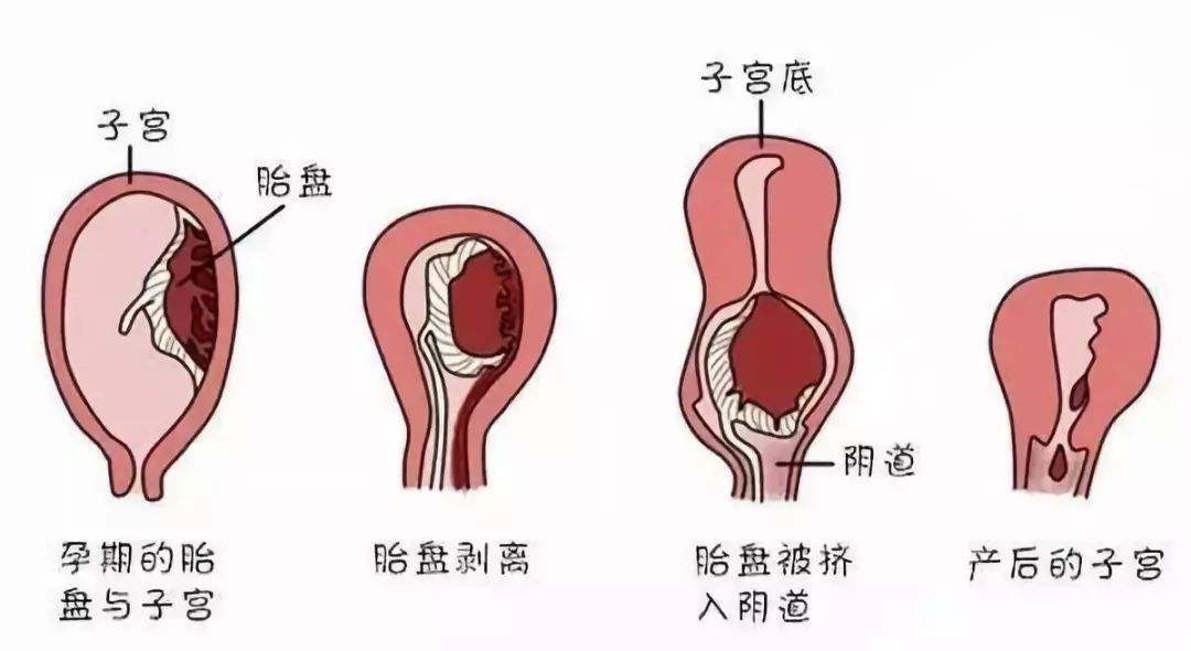 月经前半个月乳房胀痛的原因解析