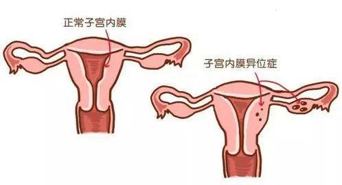 关于月经两个月来一次的现象，这背后涉及多种因素，是每位女性都可能遇到的生理现象。以下从不同角度探讨这一现象及其可能的原因。