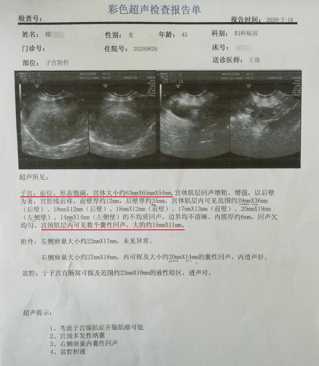 两个月B超单引发的深度思考