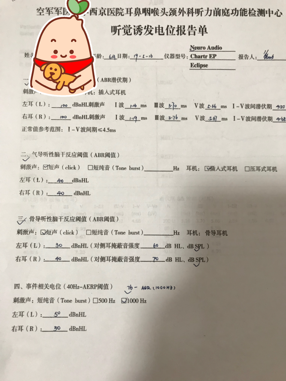 关于一个月宝宝听力未通过的问题